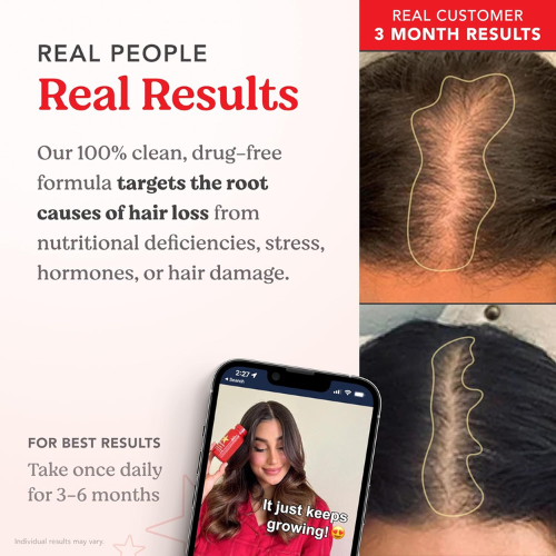 Hairtamin Advanced Formula 30 Vegan Capsules 4
