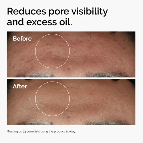 The Ordinary Niacinamide 10% + Zinc 1% - 30 ml 3